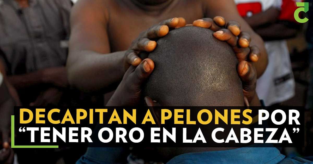 Decapitan a pelones por tener oro en la cabeza