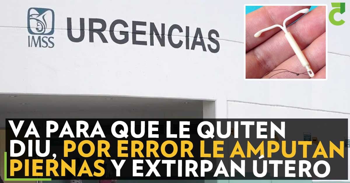 Va para que le quiten DIU por error le amputan piernas y extirpan útero 